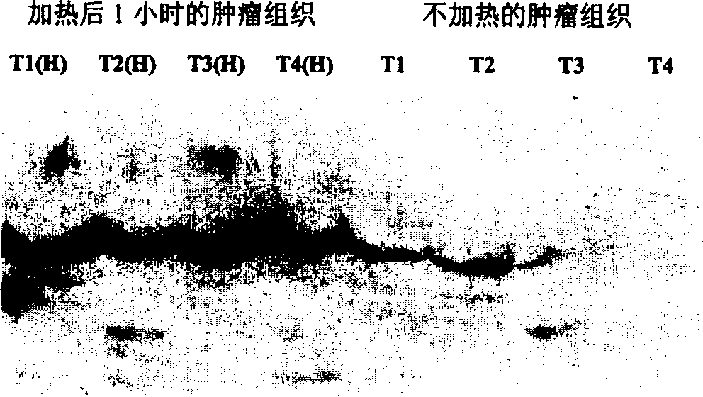 Preparation of antigen sensitized human dendron shaped cell and its use