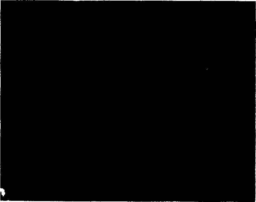 Preparation of antigen sensitized human dendron shaped cell and its use