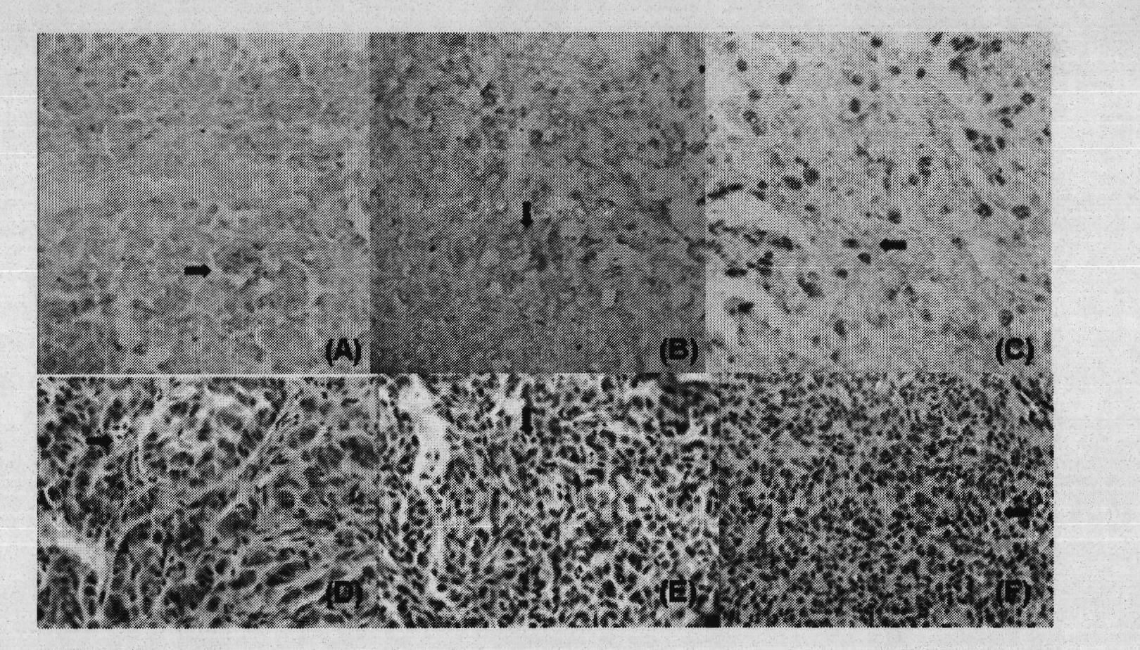 Method for preparing human interleukin 28A by silkworm bioreactor and pharmaceutical application thereof