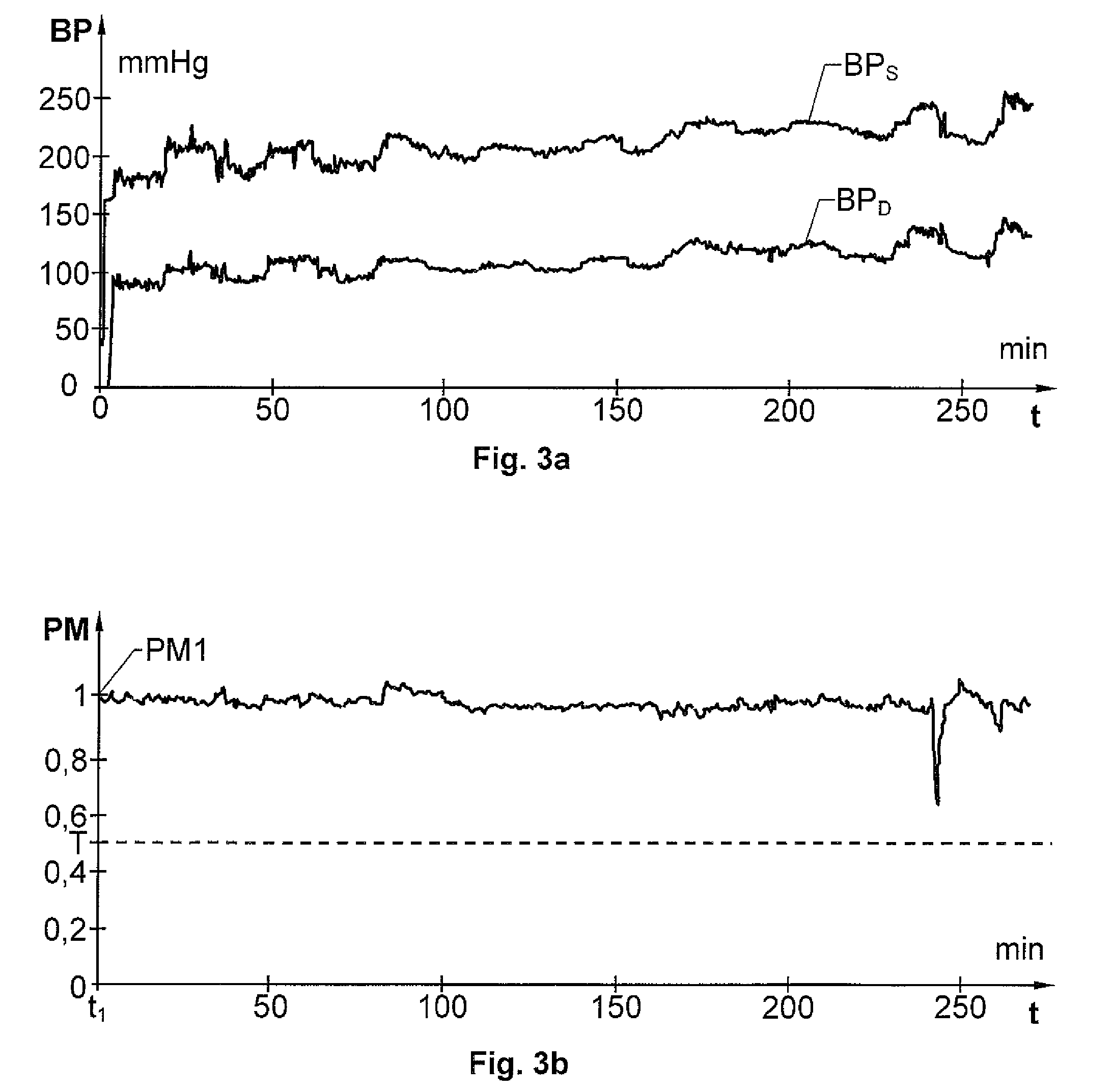 Prediction of rapid symptomatic blood pressure decrease