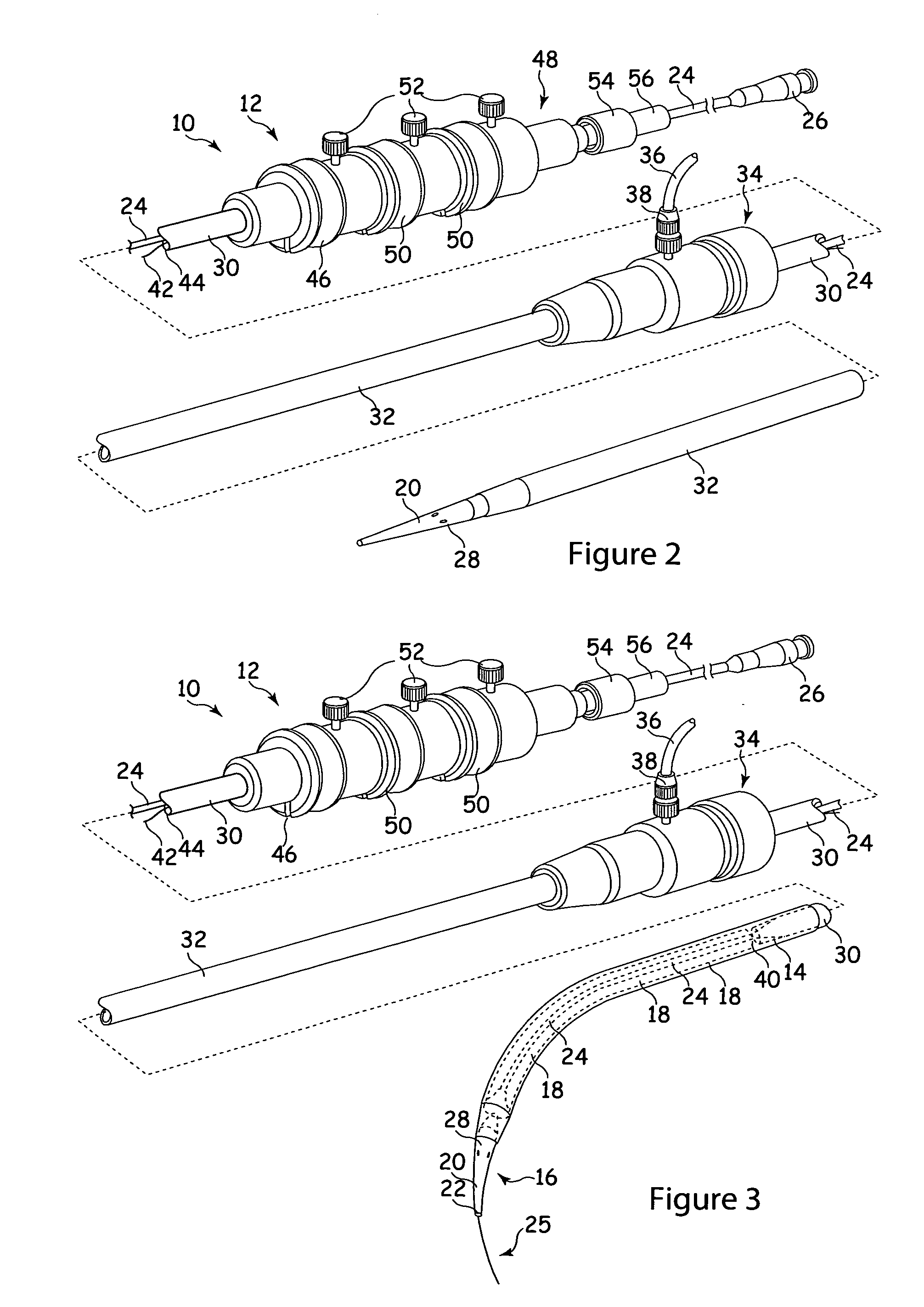 Stent-graft and apparatus and fitting method