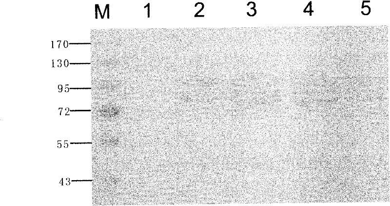 Method for efficiently expressing DNA polymerase by using pichia pastoris