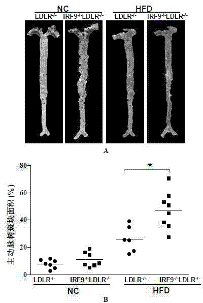 The function and application of irf9 gene in atherosclerosis