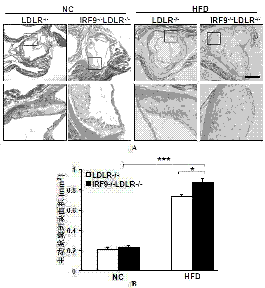 The function and application of irf9 gene in atherosclerosis