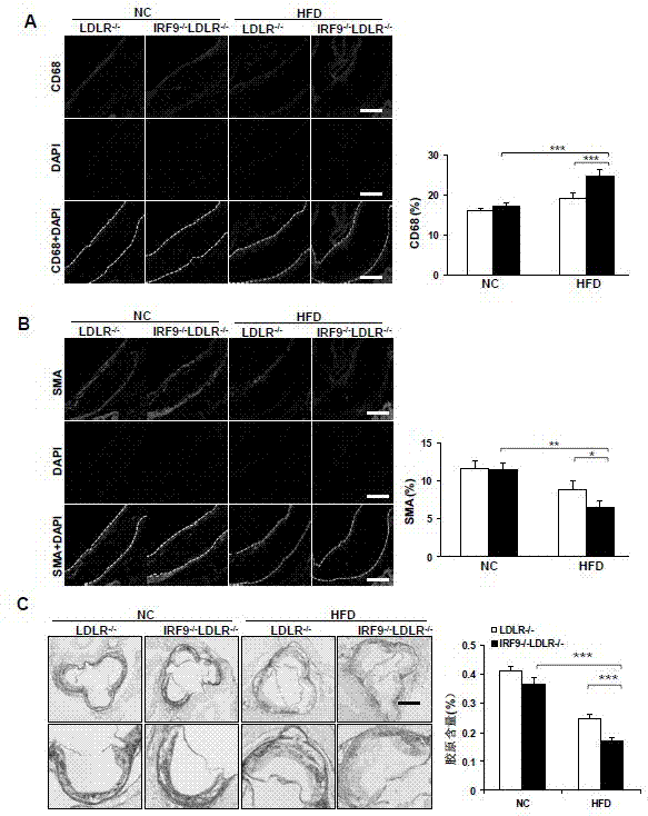 The function and application of irf9 gene in atherosclerosis