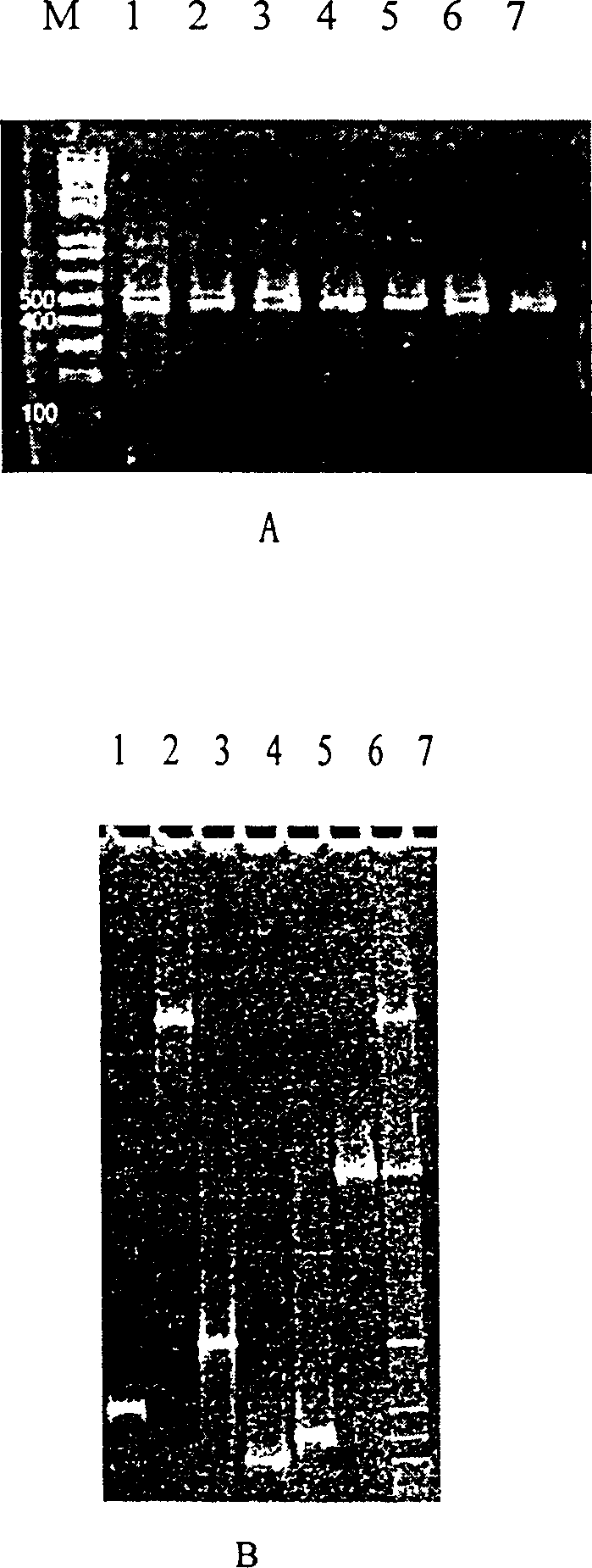 Method for quick trace synchronous detection of bacteria
