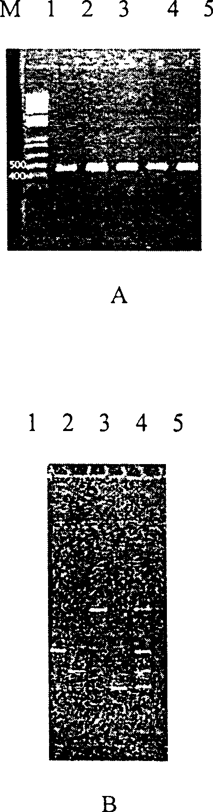Method for quick trace synchronous detection of bacteria