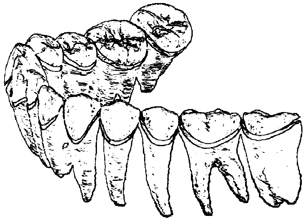 A 3D Model Fusion Method of Crown and Root