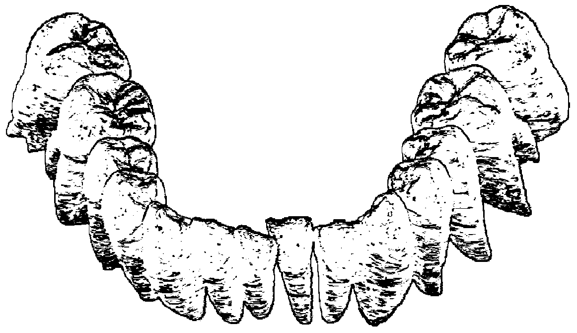 A 3D Model Fusion Method of Crown and Root