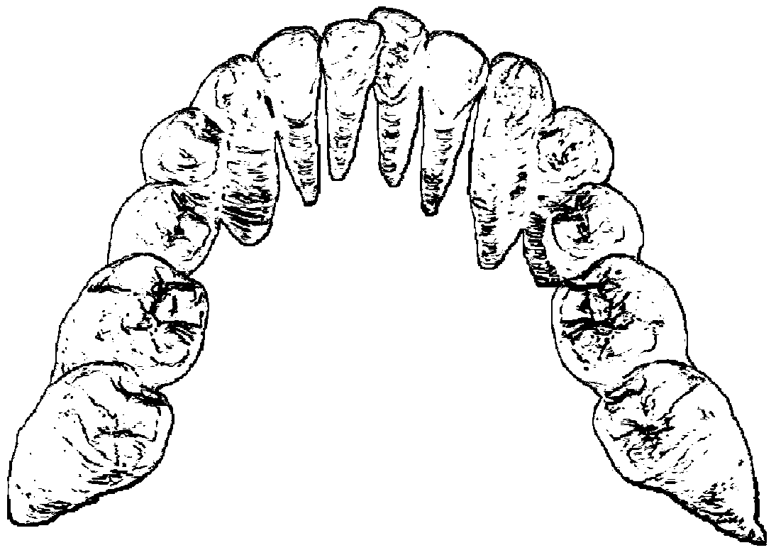 A 3D Model Fusion Method of Crown and Root