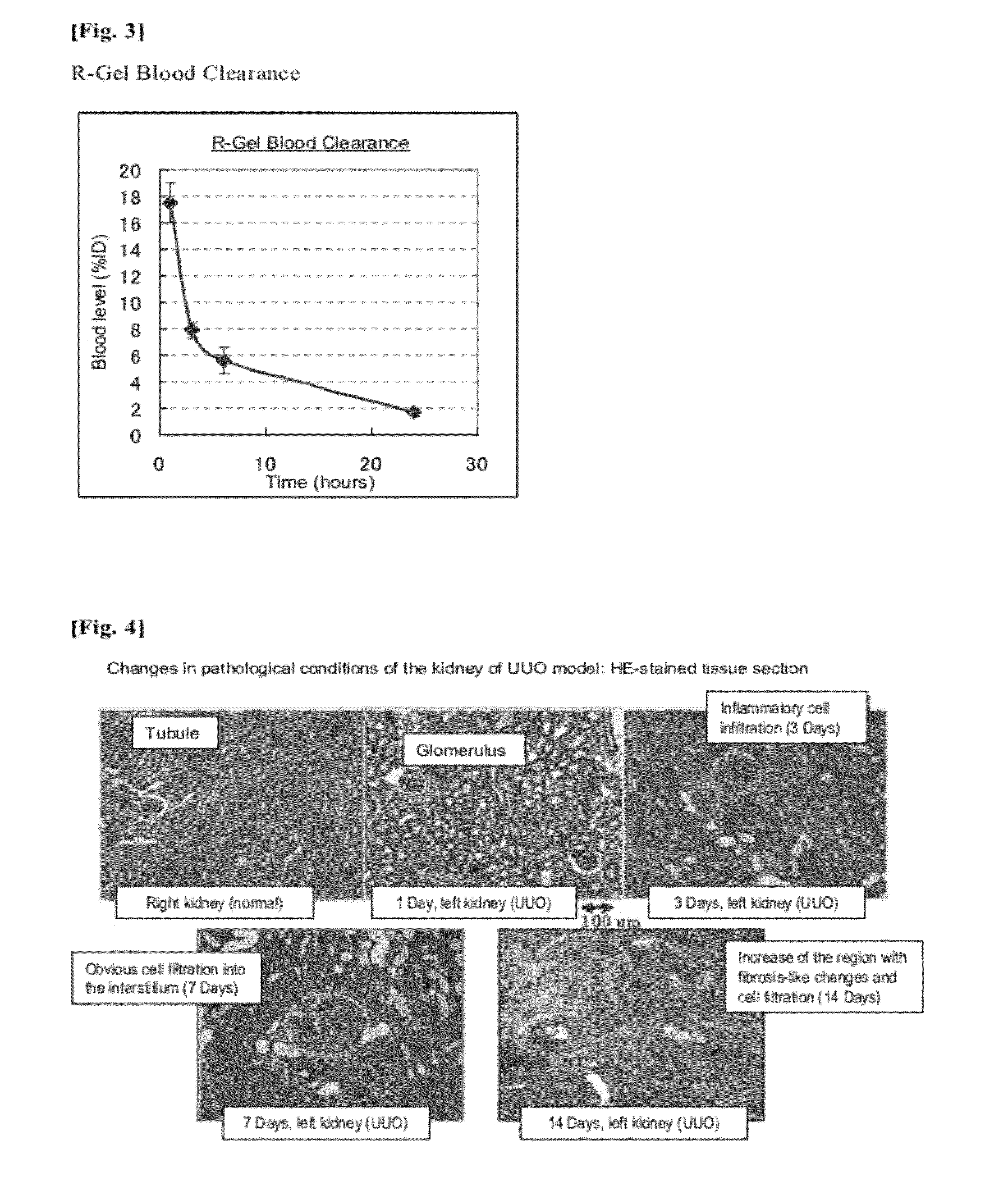 Kidney-imaging agent comprising recombinant gelatin