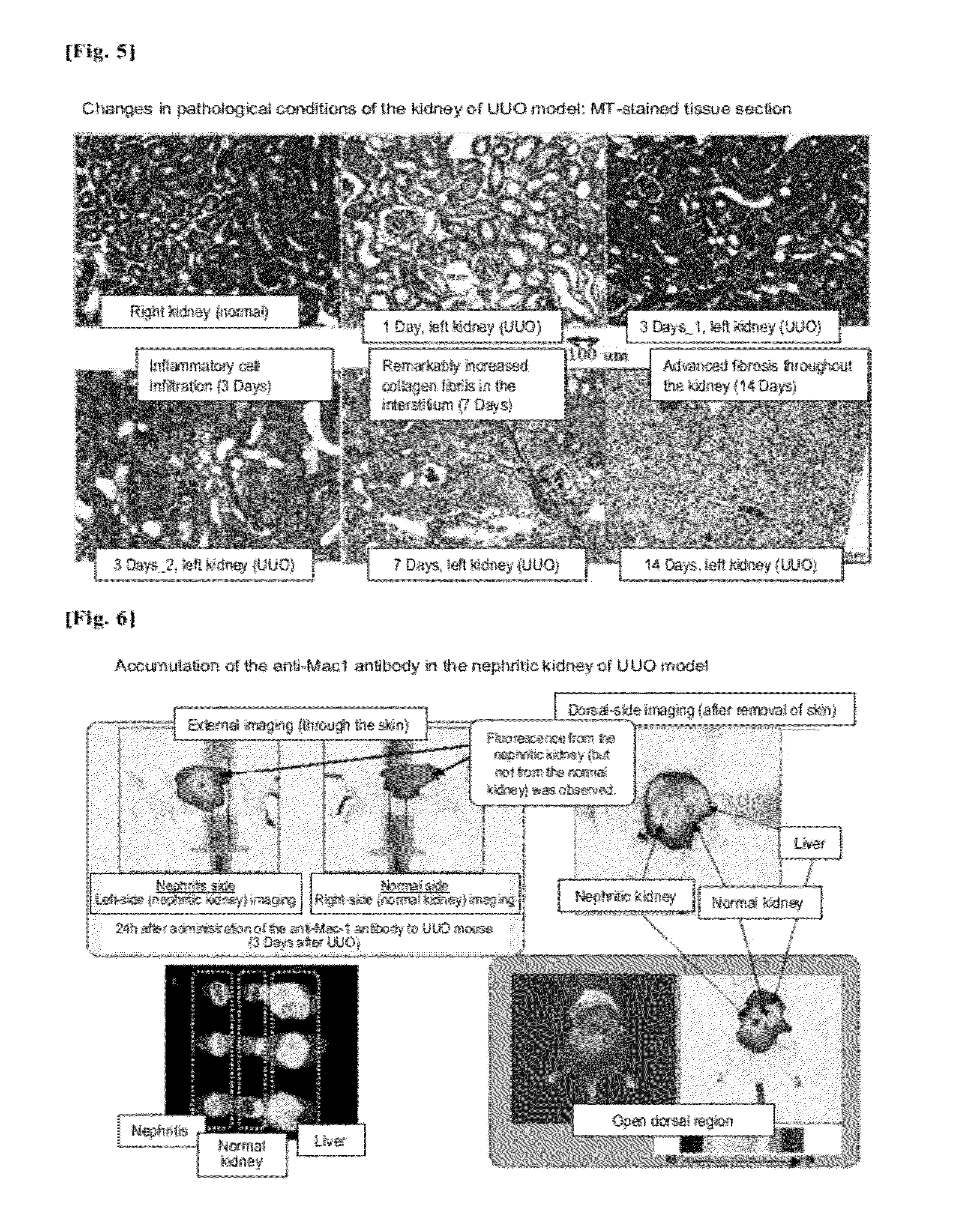 Kidney-imaging agent comprising recombinant gelatin