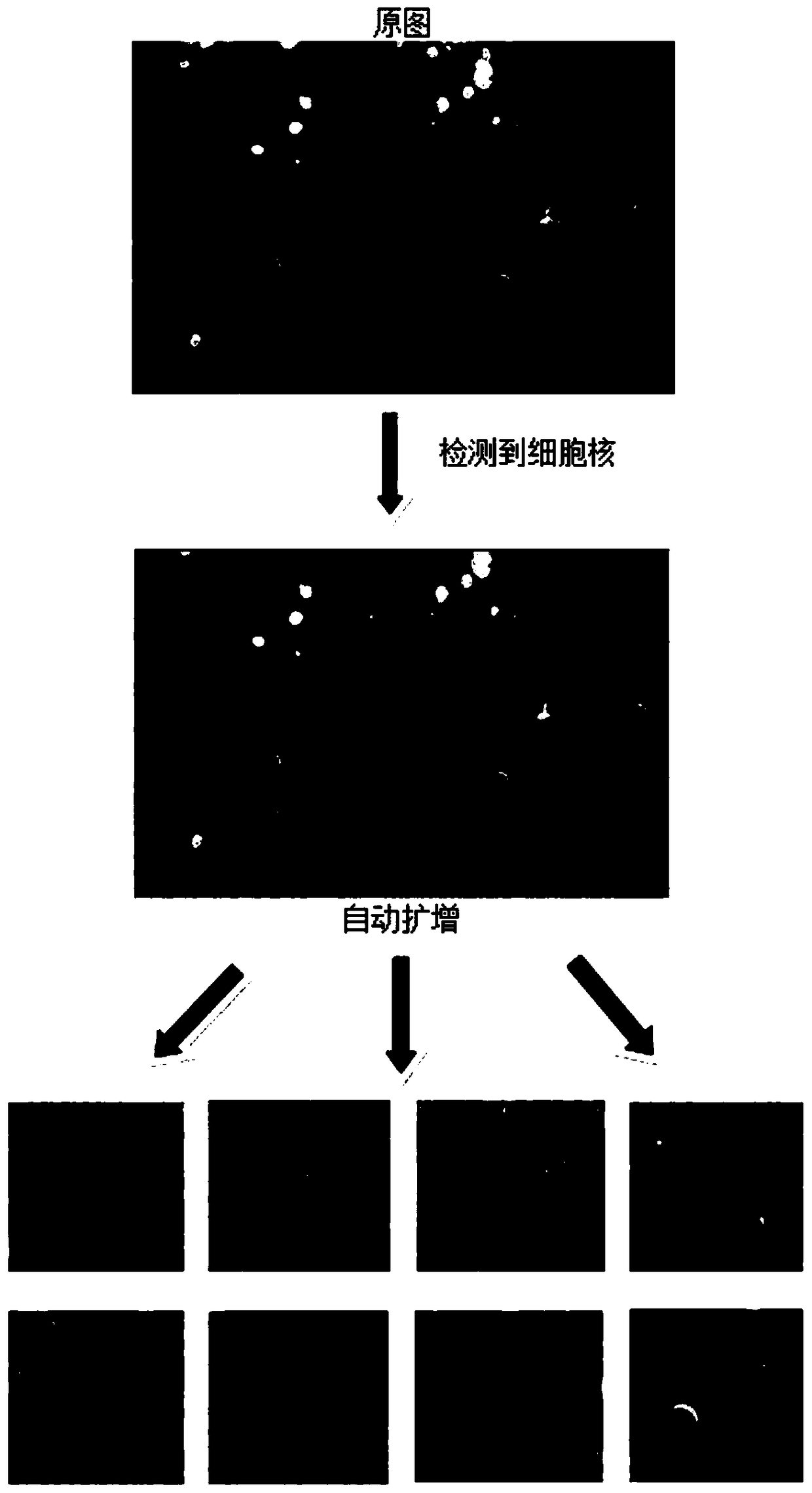 Thyroid tumor pathological tissue section image classification method and device