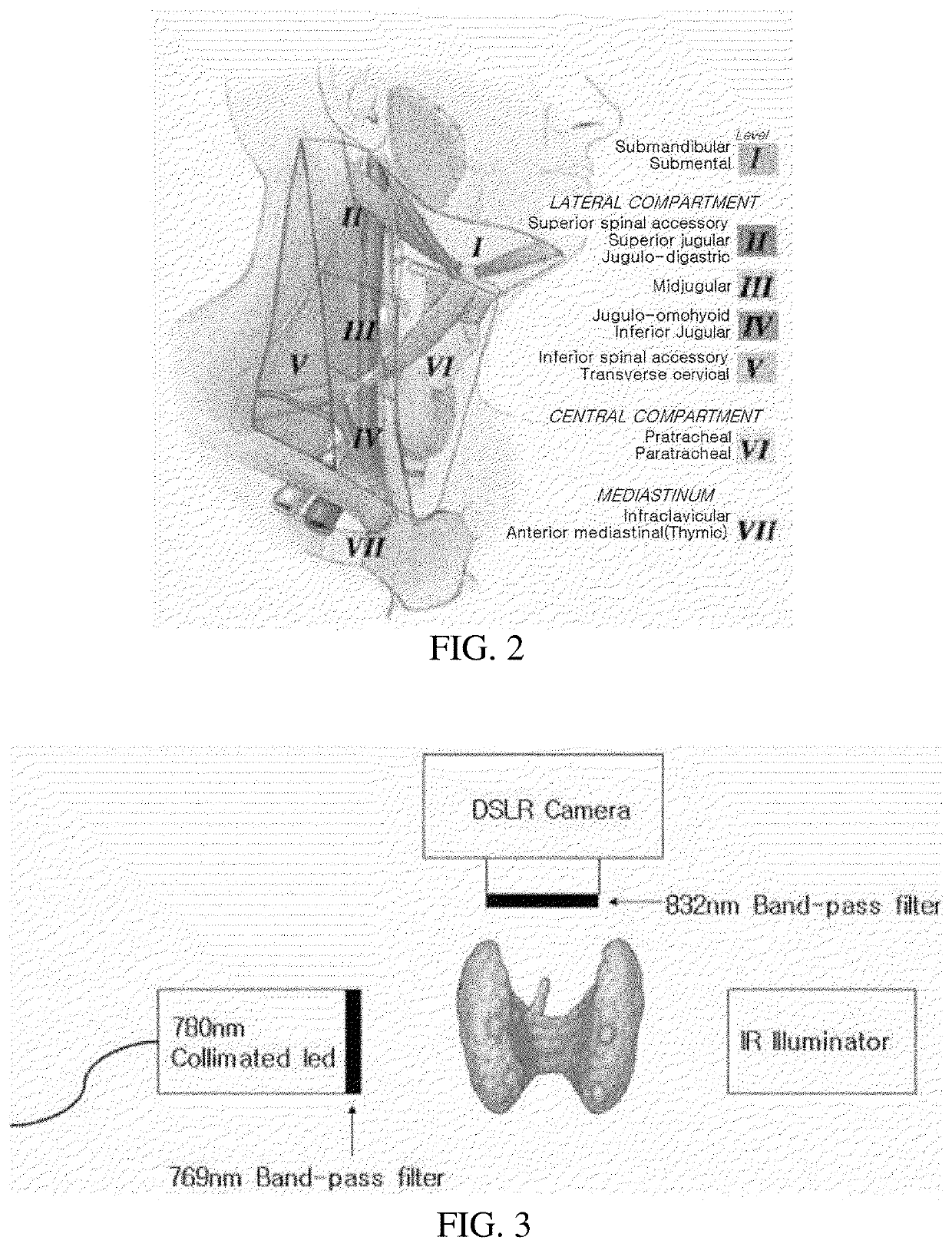 Real-time parathyroid imaging device