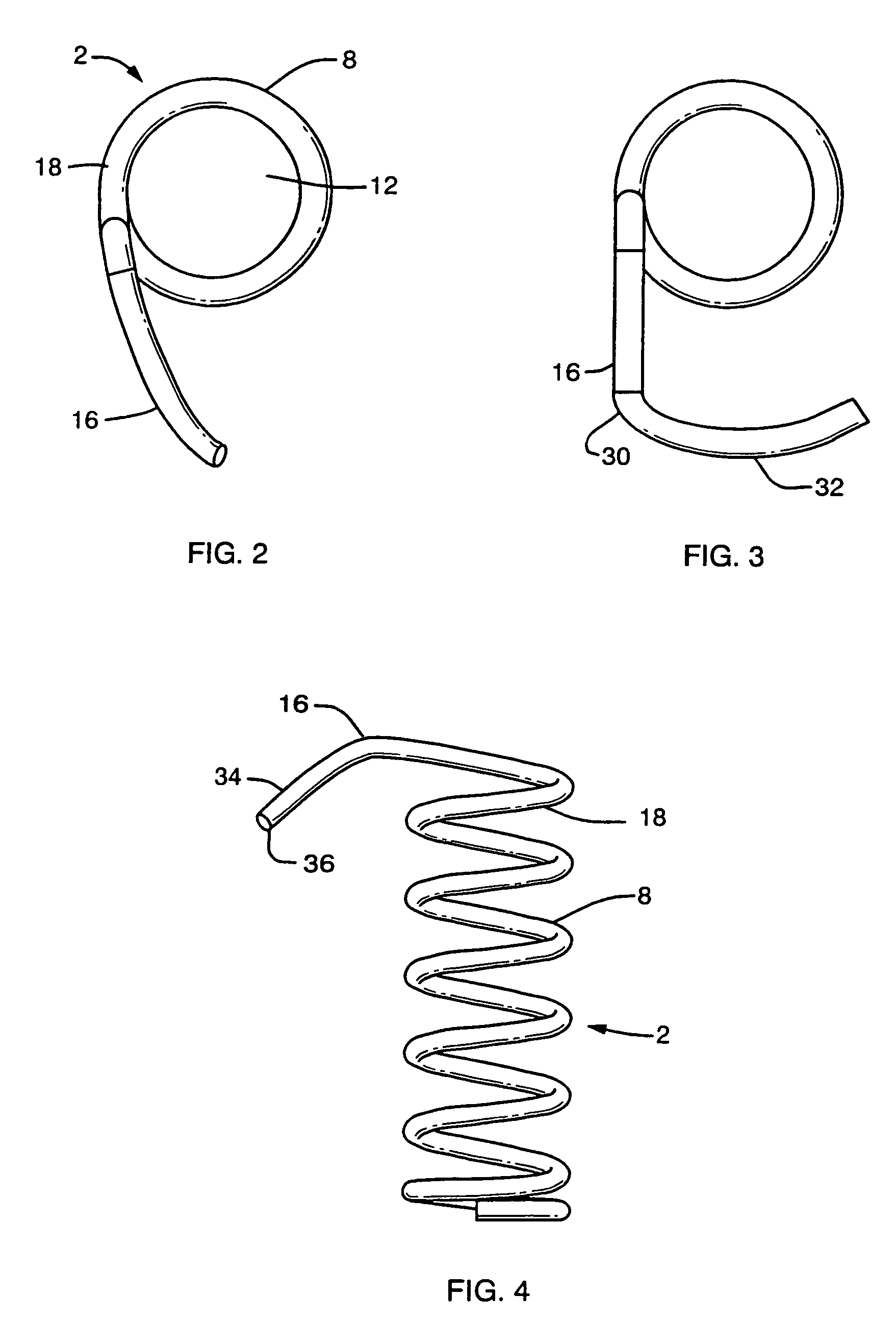 Implant anchor systems