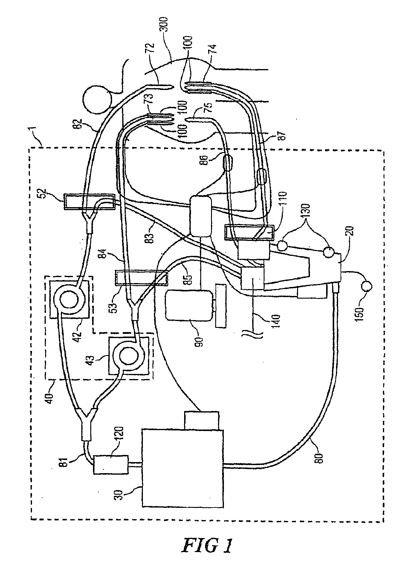 System for chemohyperthermia treatment