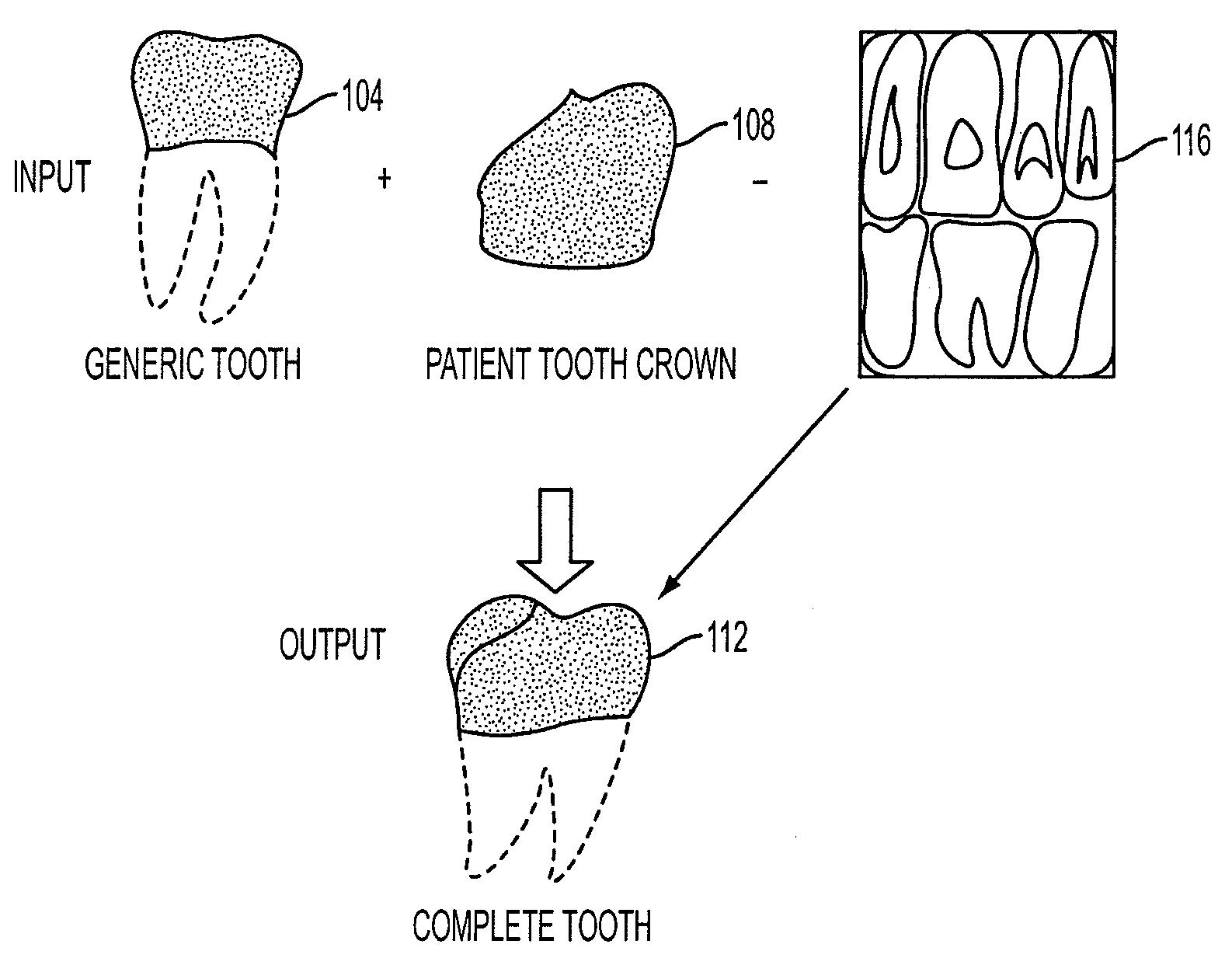 System and method for improved dental geometry representation