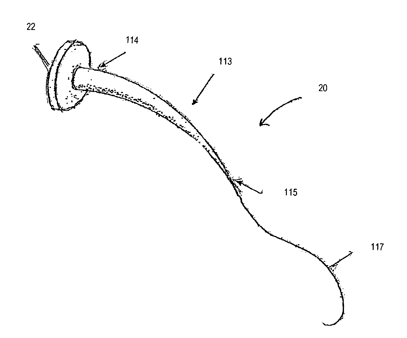 Implantable graft to close a fistula