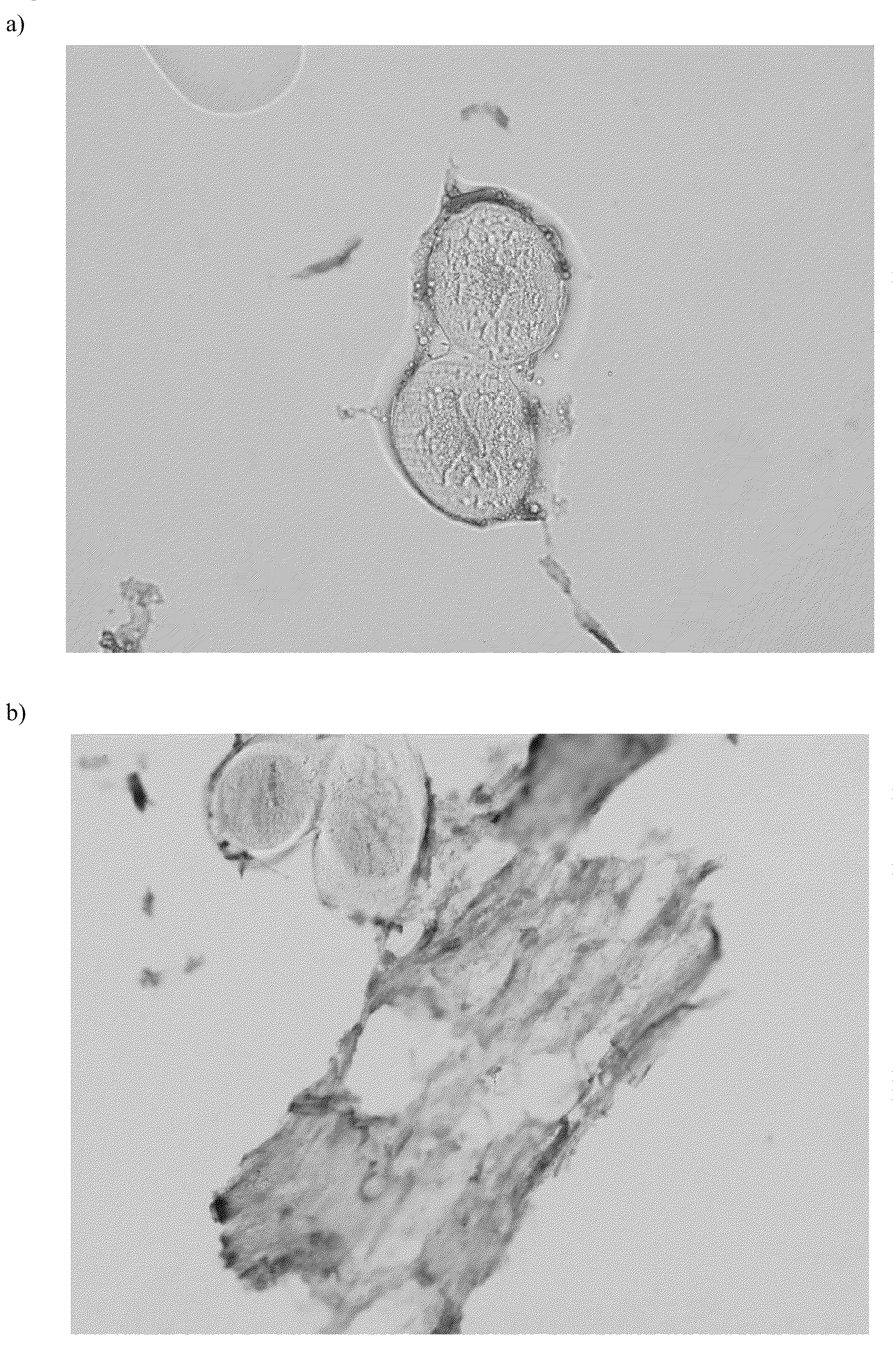 Method of cultivation of human mesenchymal stem cells, particularly for the treatment of non-healing fractures, and bioreactor for carrying out this cultivation method