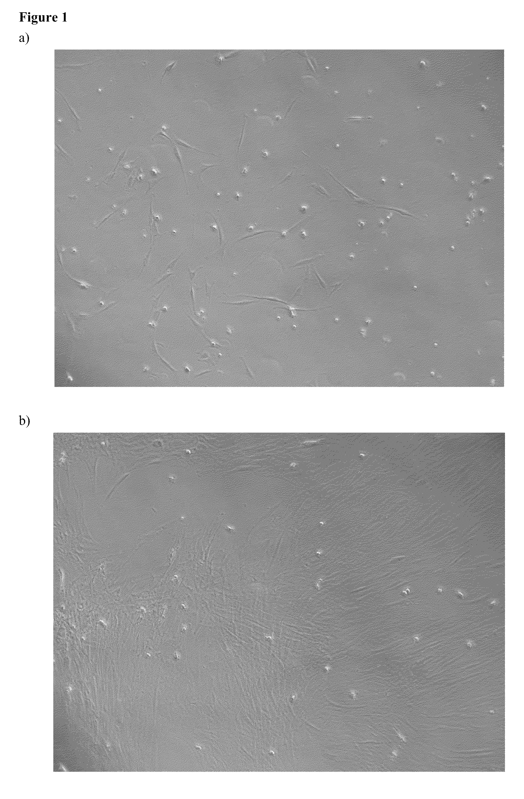 Method of cultivation of human mesenchymal stem cells, particularly for the treatment of non-healing fractures, and bioreactor for carrying out this cultivation method