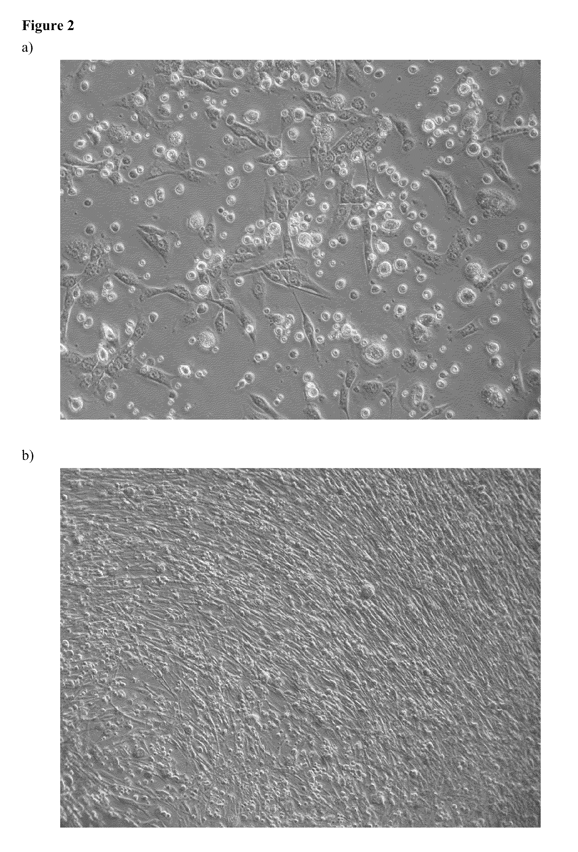 Method of cultivation of human mesenchymal stem cells, particularly for the treatment of non-healing fractures, and bioreactor for carrying out this cultivation method