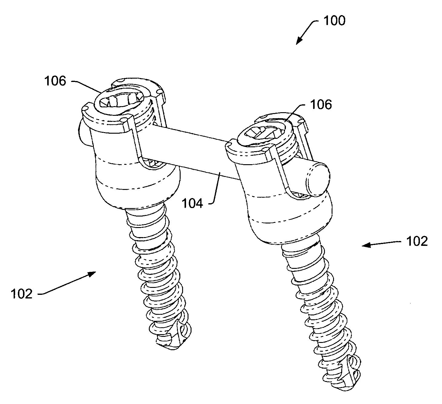 Instruments and methods for adjusting separation distance of vertebral bodies with a minimally invasive spinal stabilization procedure