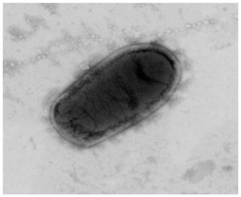 A Strain Ochrobactrum intermedium 26B and Its Application