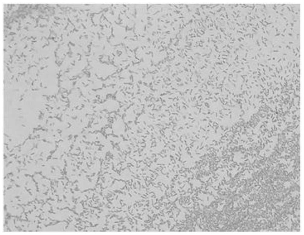 A Strain Ochrobactrum intermedium 26B and Its Application