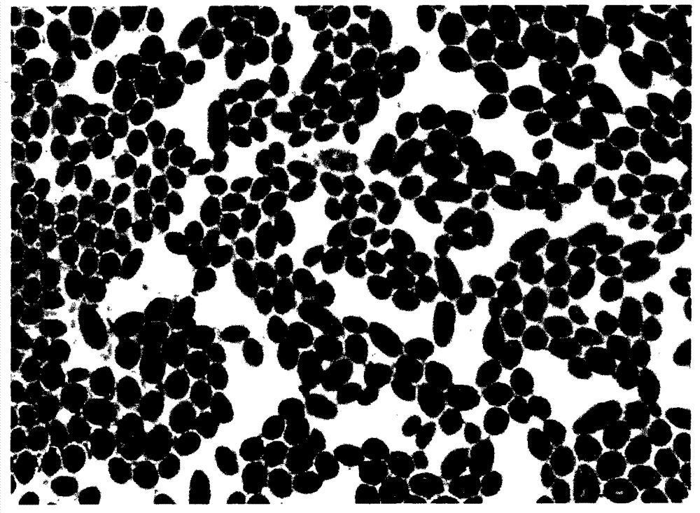 Three-step enzymatic hydrolysis method used for producing forage saccharomyces cerevisiae cells with broken-down walls