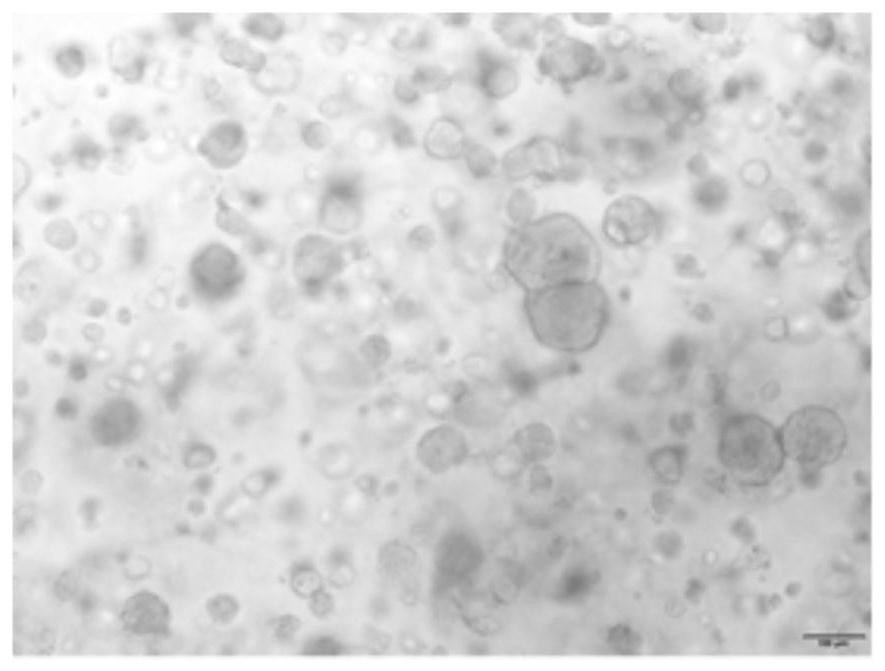 Method for culturing upper urinary tract urothelial cell carcinoma organoids