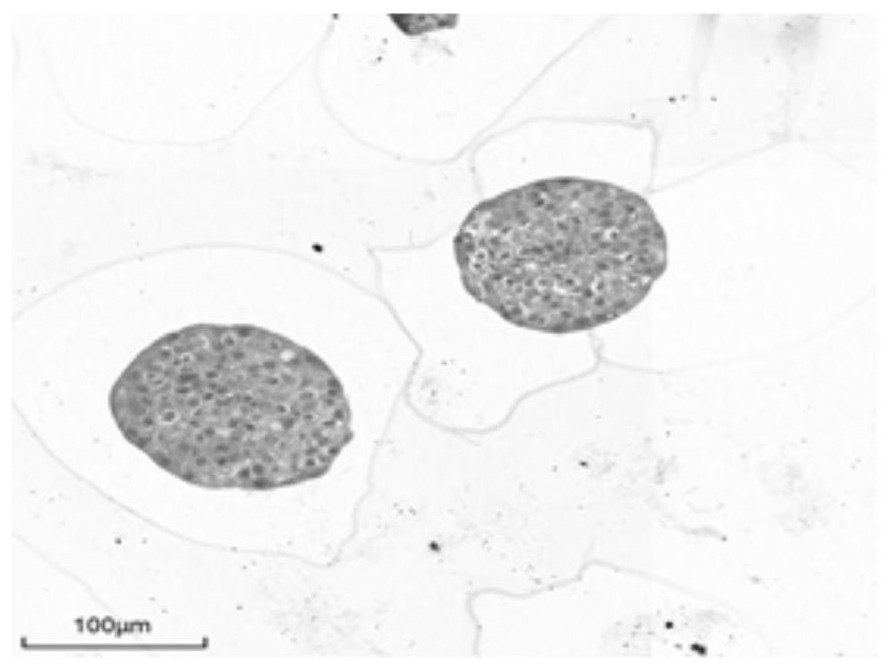 Method for culturing upper urinary tract urothelial cell carcinoma organoids