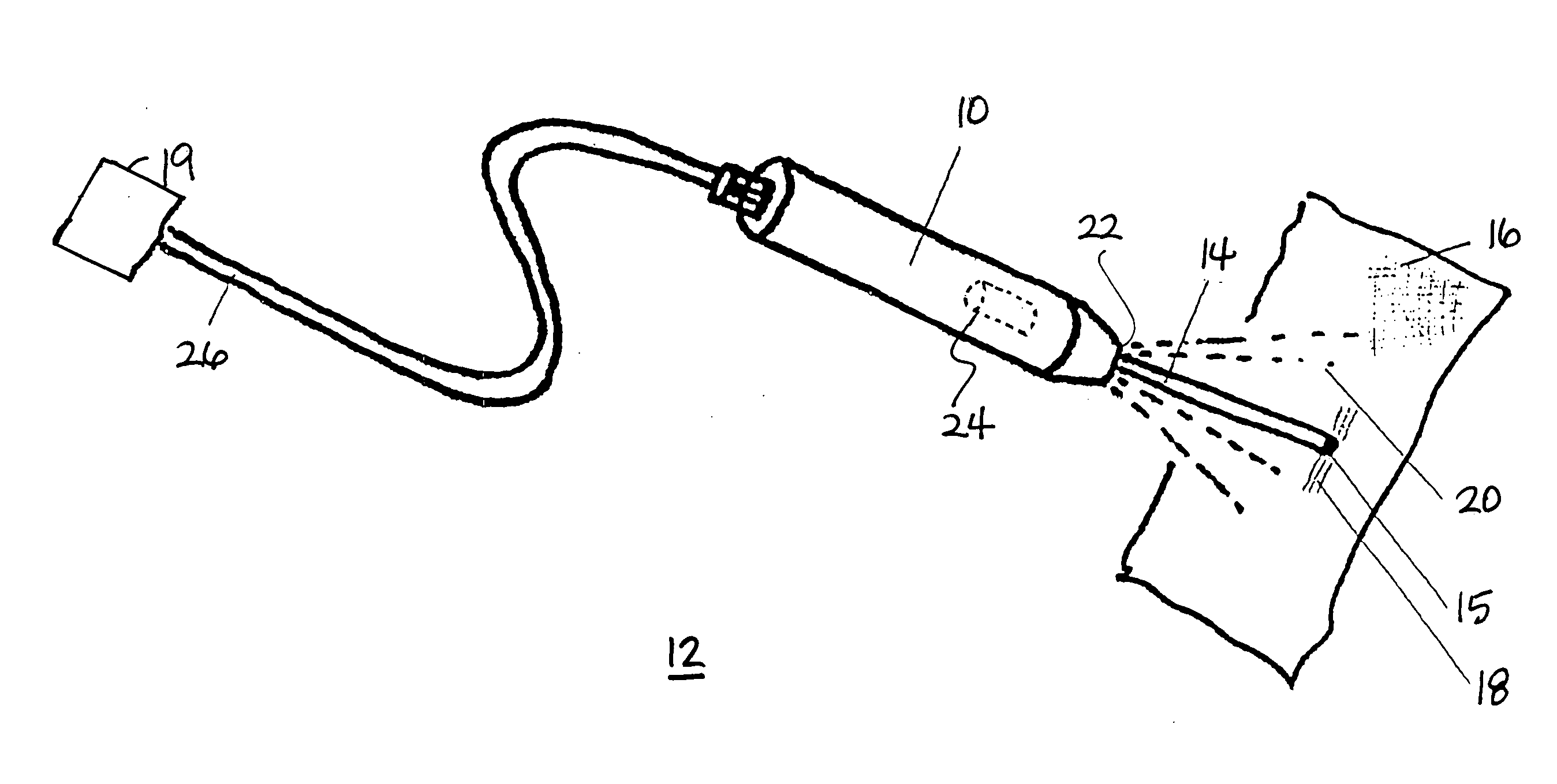 Device for the cleaning wounds by means of laser