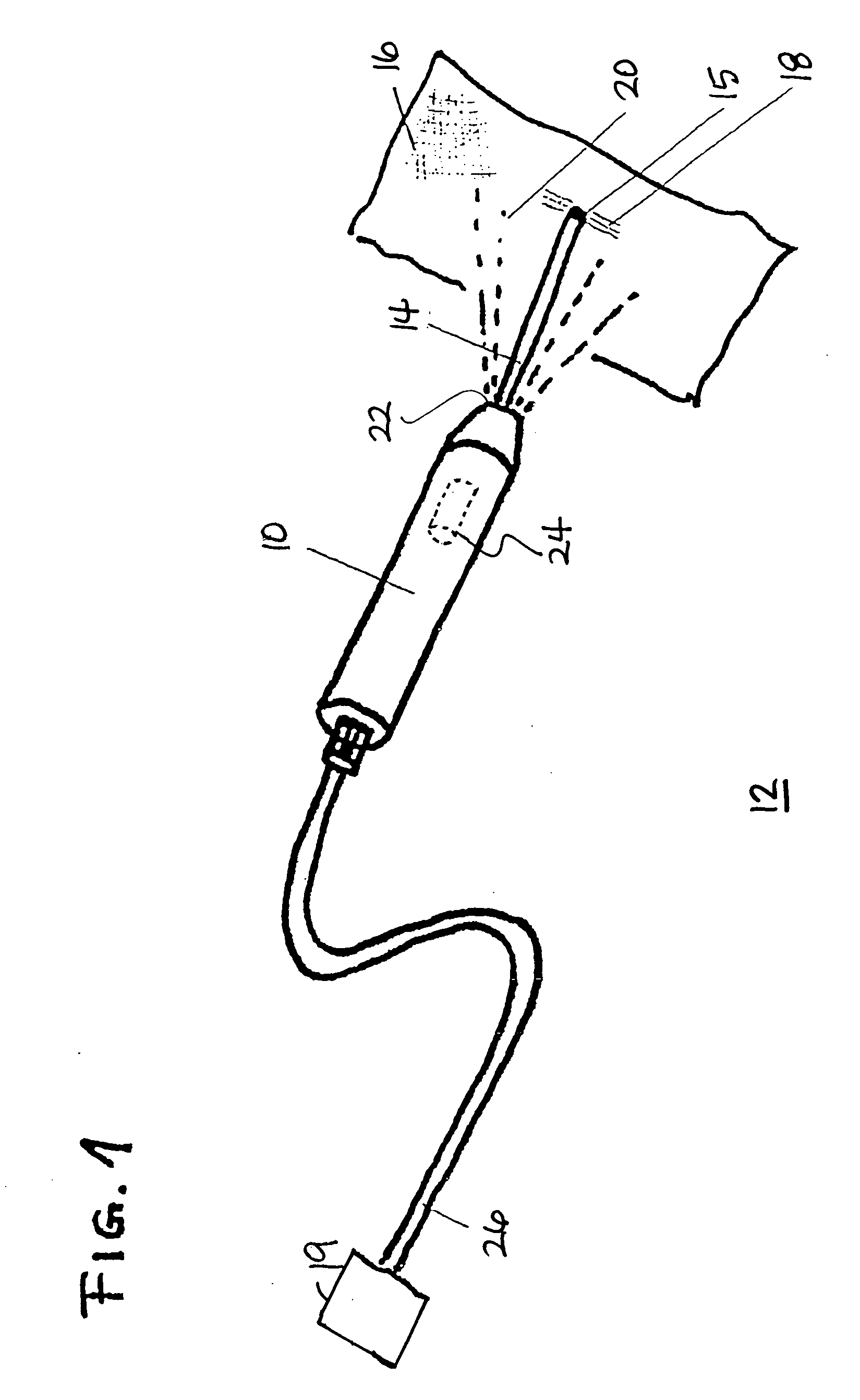 Device for the cleaning wounds by means of laser