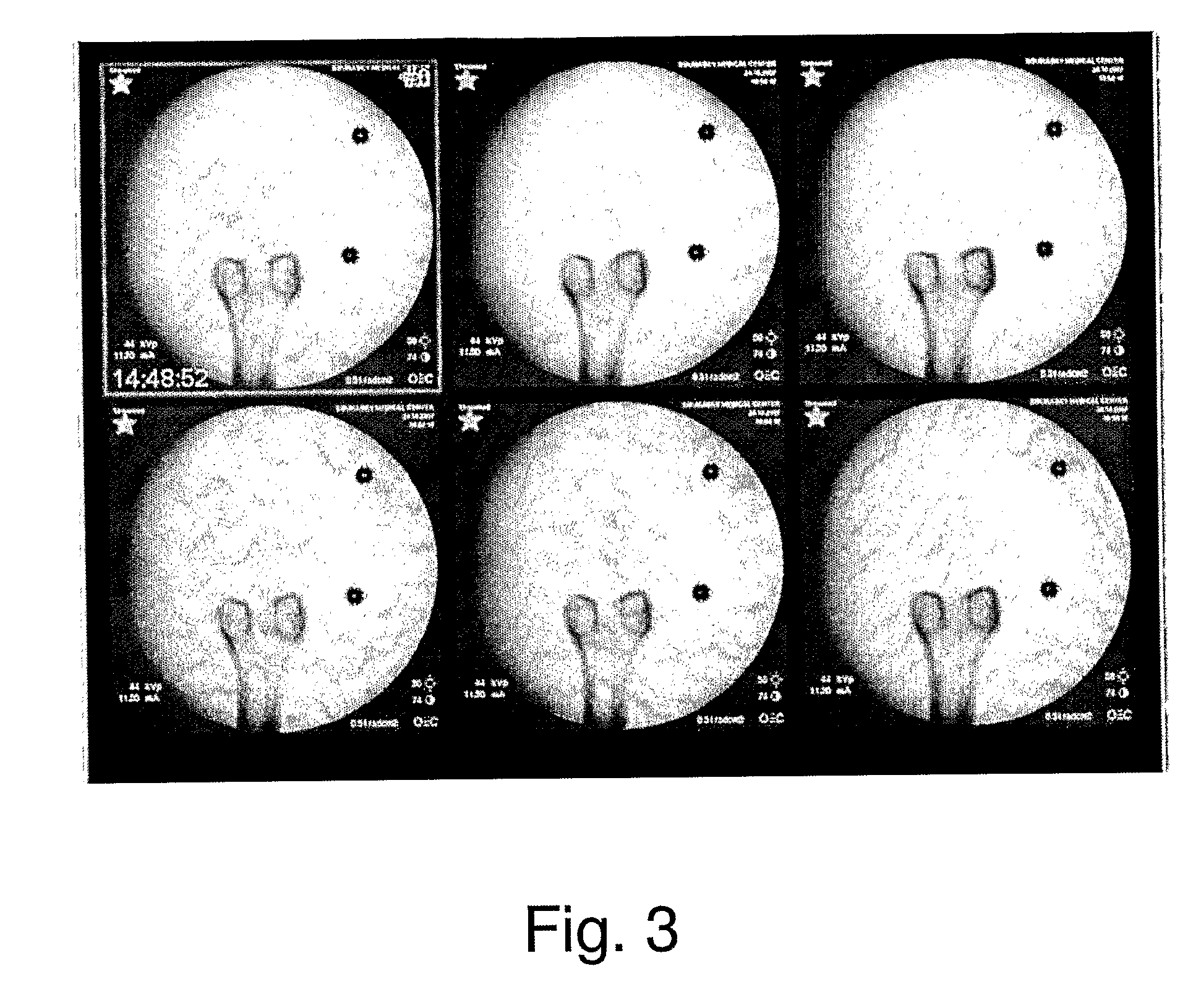 Method and system for stitching multiple images into a panoramic image