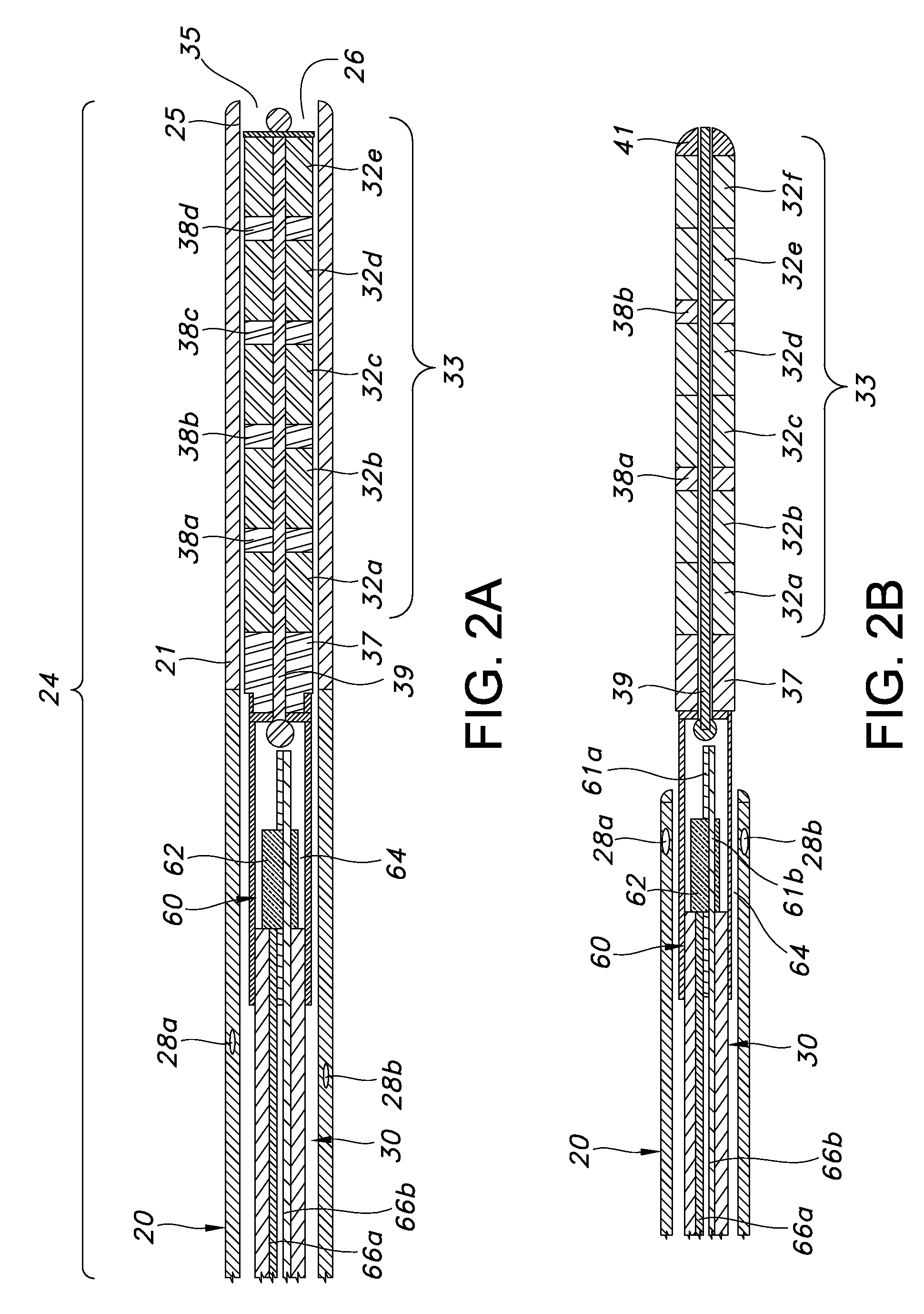 Guided catheter with removable magnetic guide