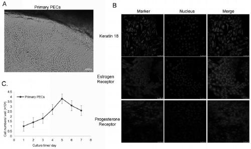 Porcine endometrium epithelial cell line susceptible to PRRSV and construction method of cell line