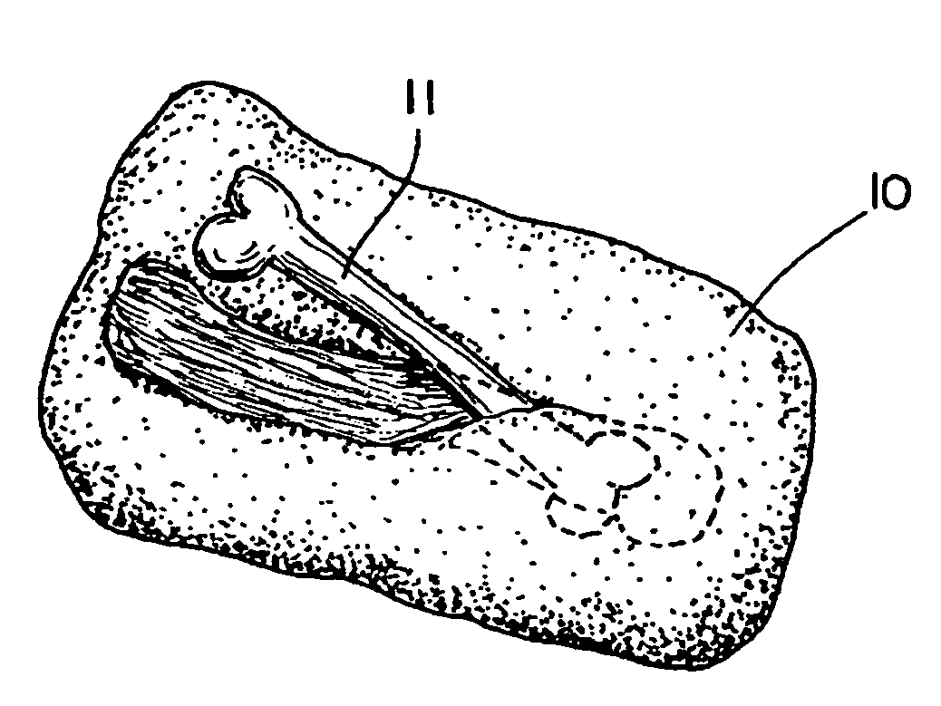 Method of making food products from the thigh of a bird and food products made in accordance with the method