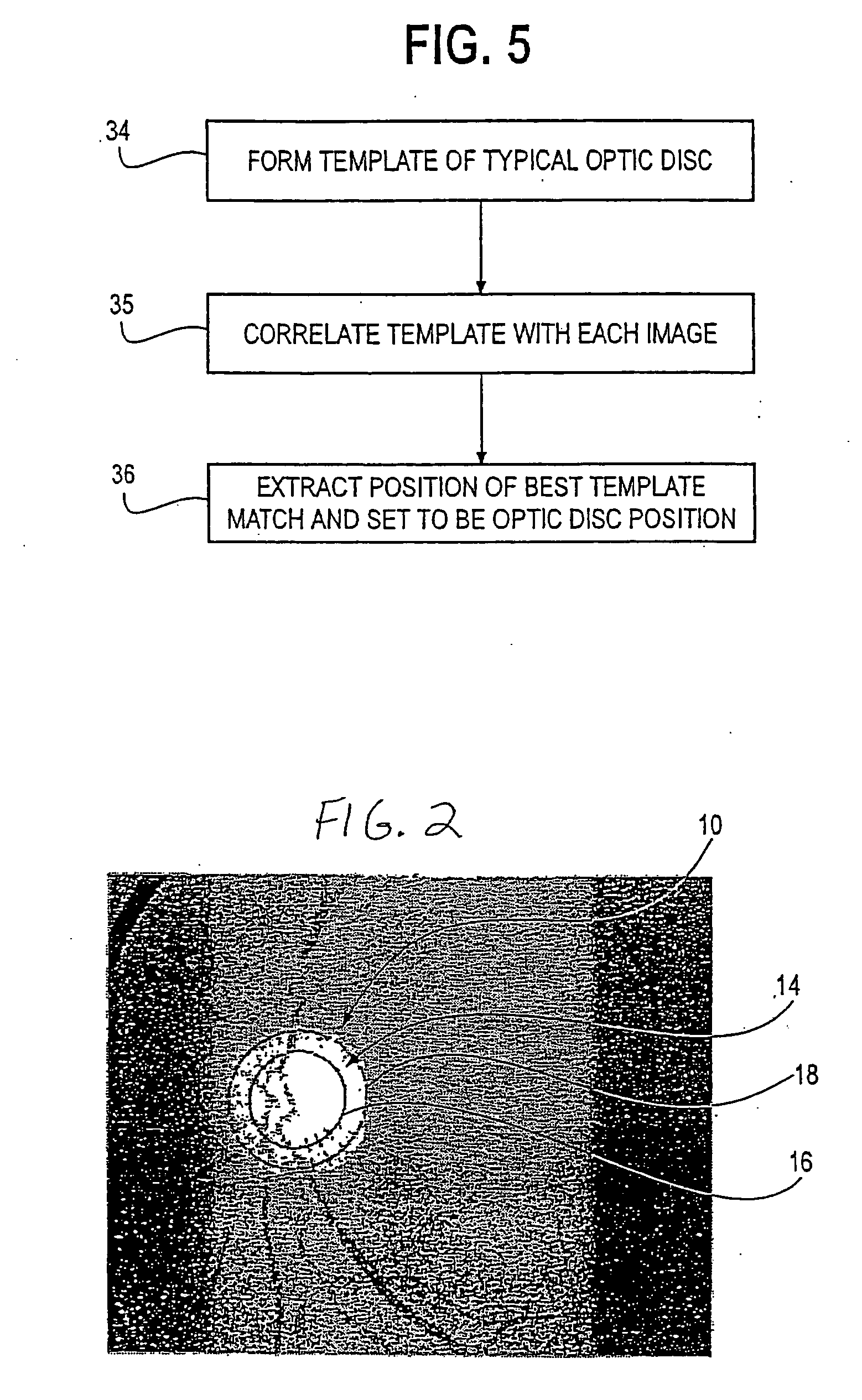 Method and system for automatically capturing an image of a retina