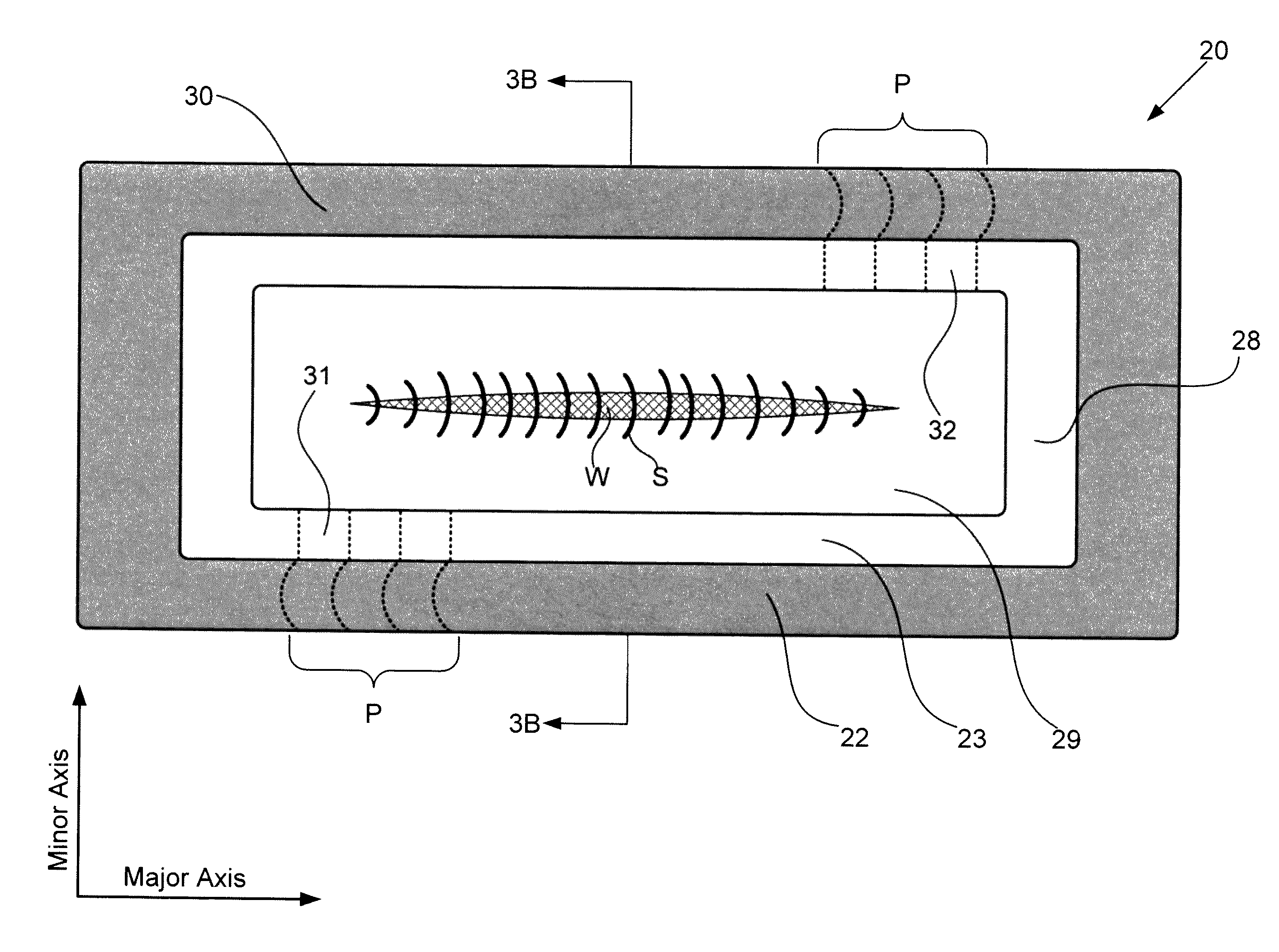 Systems and methods for protecting incisions