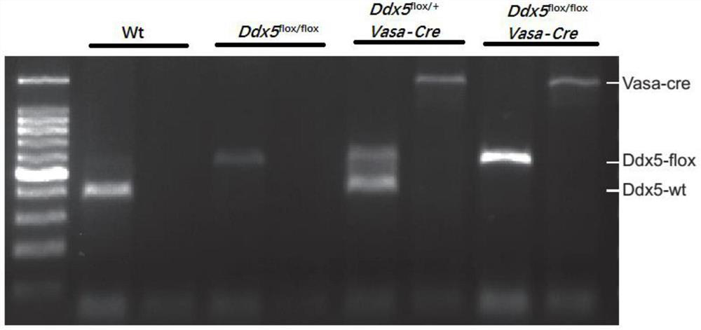 Mouse model of spermatogenesis disorder with ddx5 gene deletion and its construction method