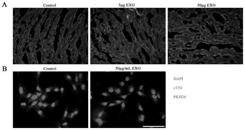 Exosome derived from human umbilical cord mesenchymal stem cells, and identification method and application of exosome
