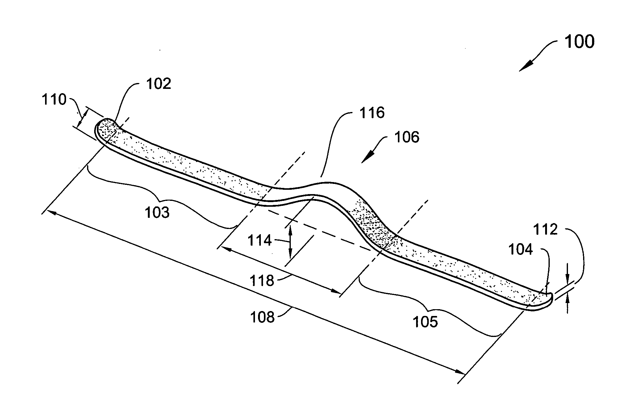 Systems, devices and methods relating to a shape resilient sling-like support for treating urinary incontinence