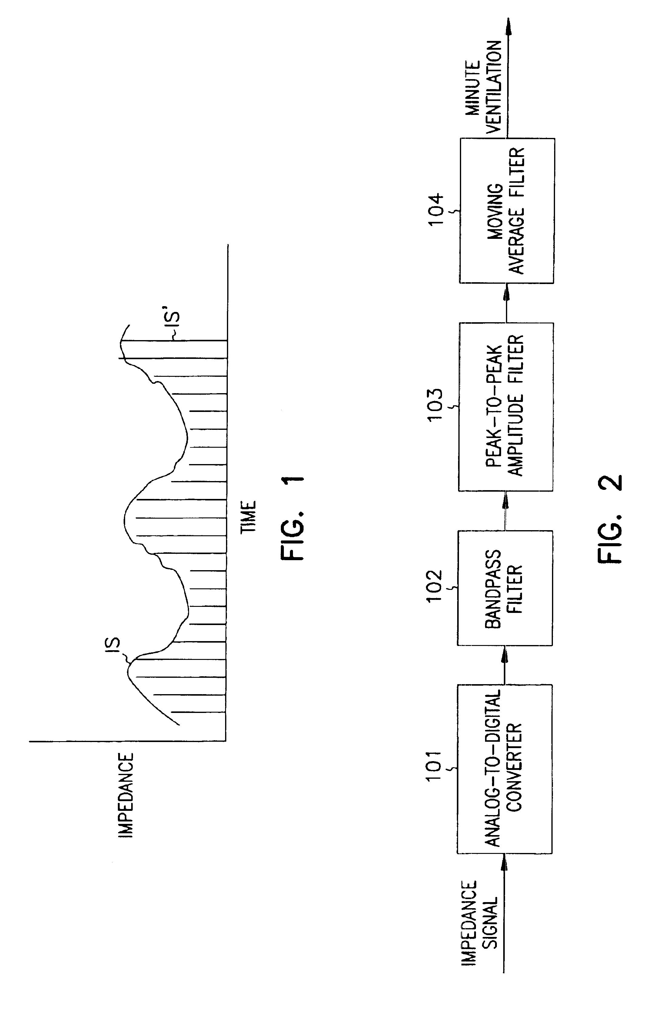 Minute ventilation sensor with automatic high pass filter adjustment