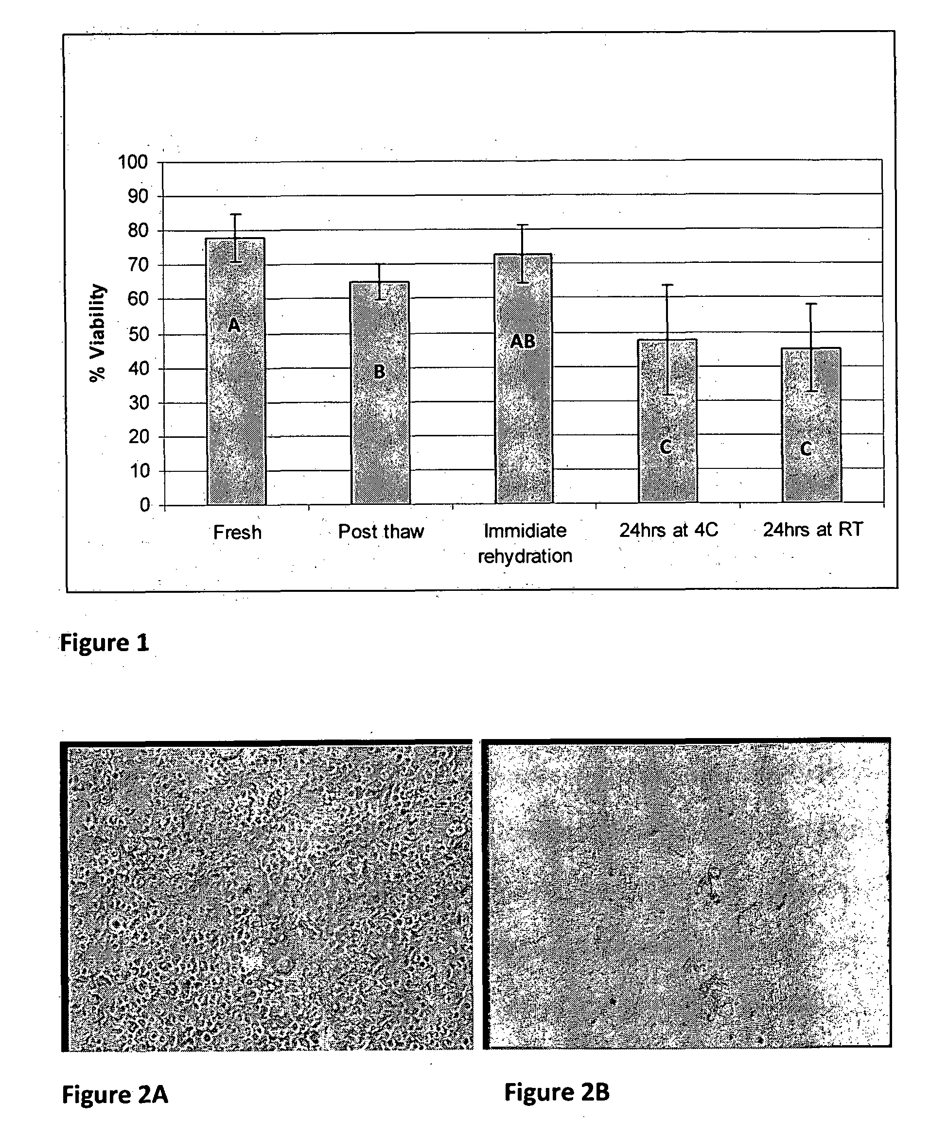 Method for preserving cancellous bone samples and preserved cancellous bone tissue