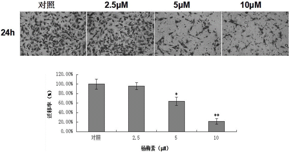 Myricetin extract, medicine composition containing myricetin extract and purposes thereof