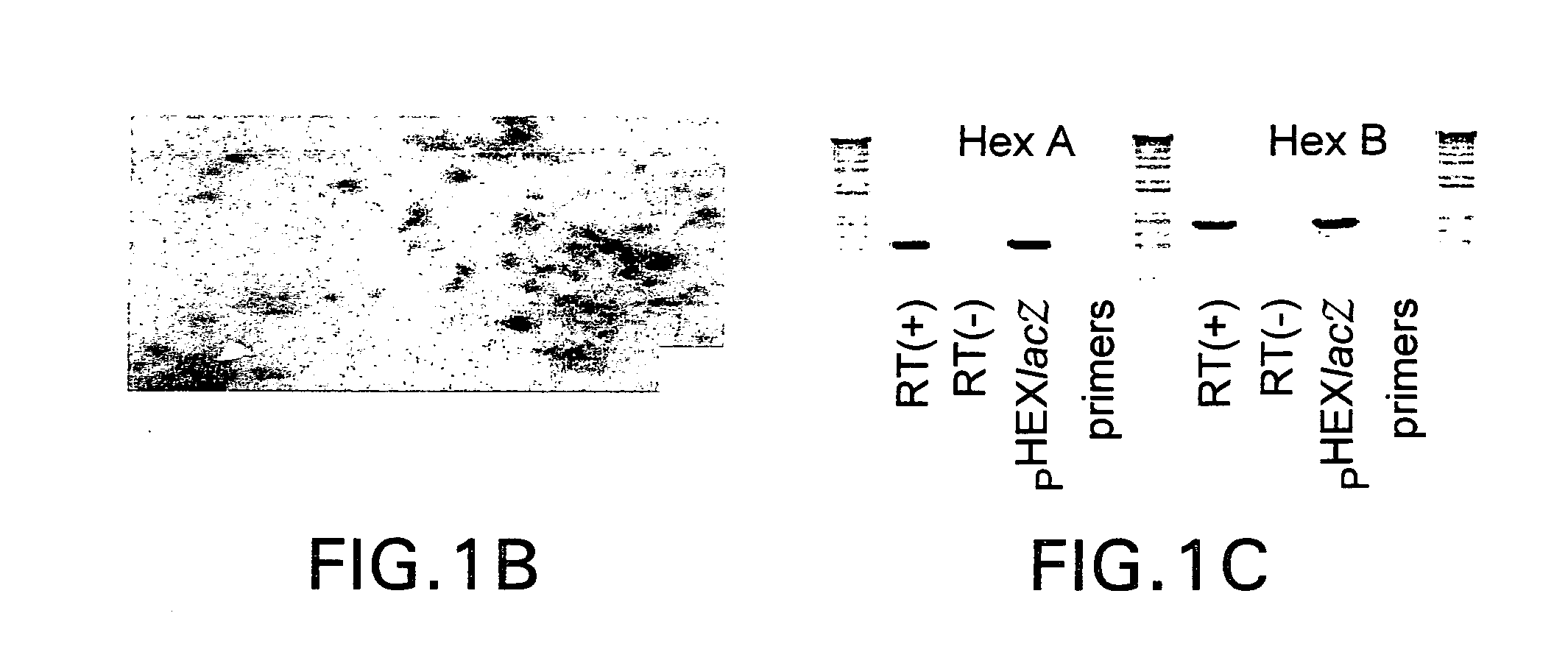 Vectors having both isoforms of beta-hexosaminidase