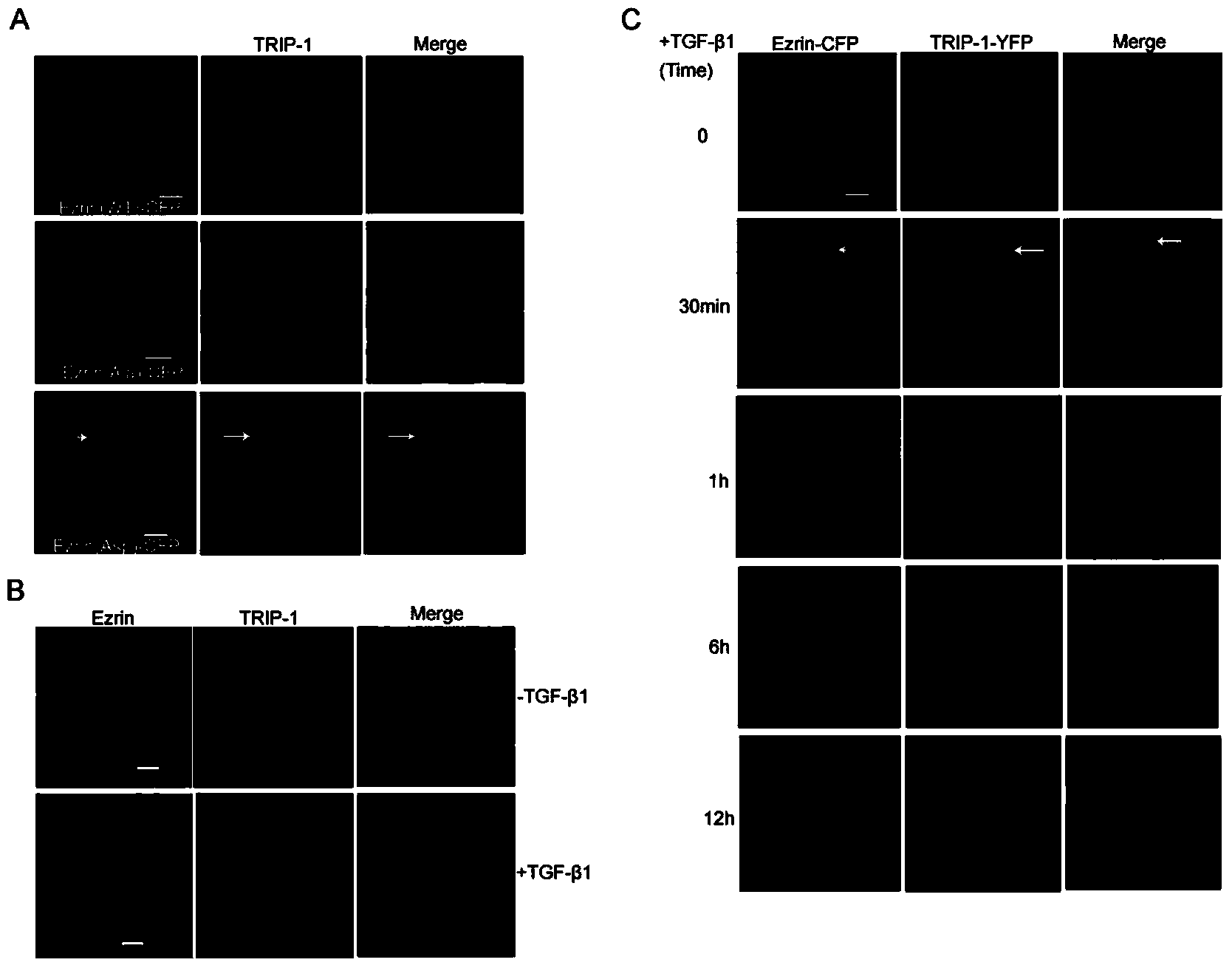 Novel use of TGF (Transforming Growth Facto)-beta receptor binding protein-1