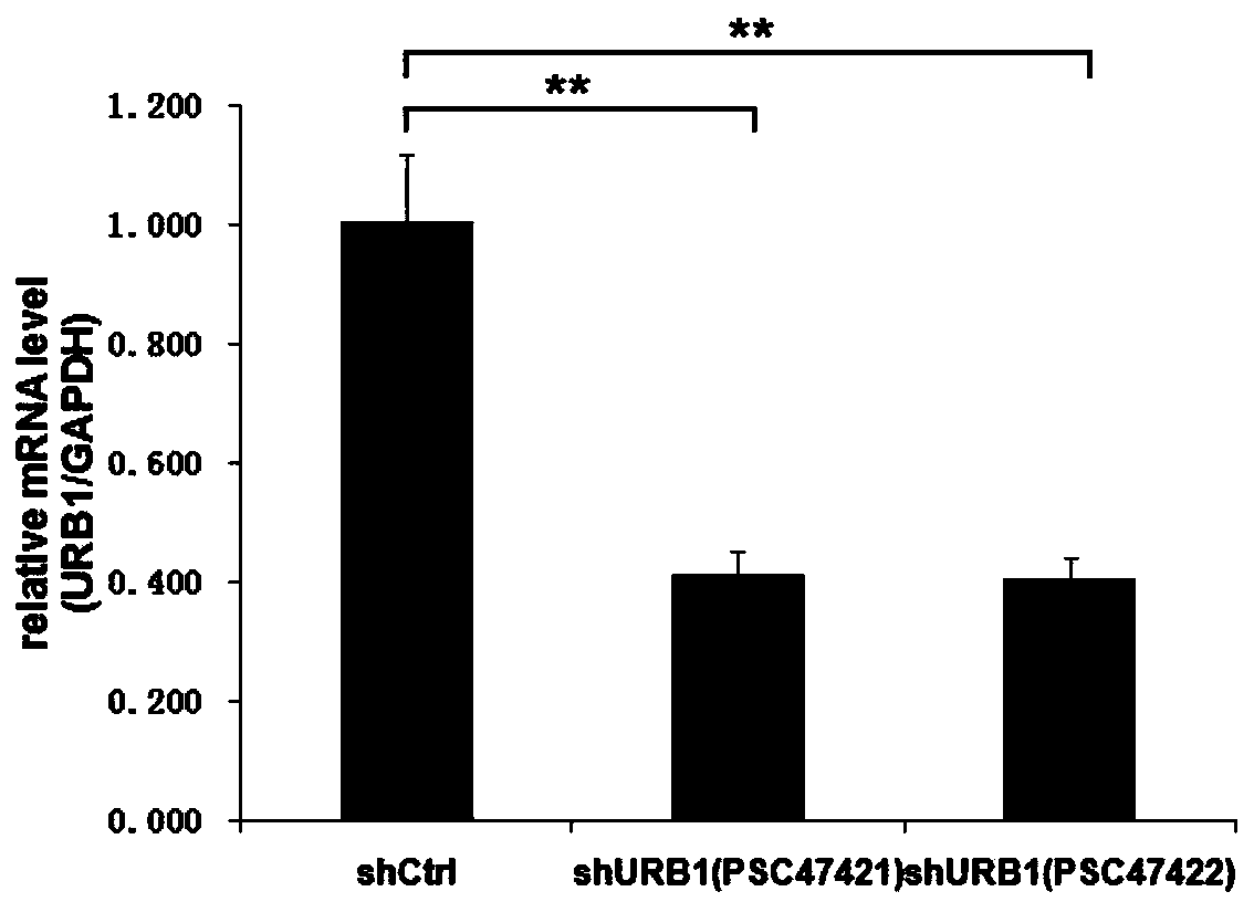 Application of human URB1 gene and related products