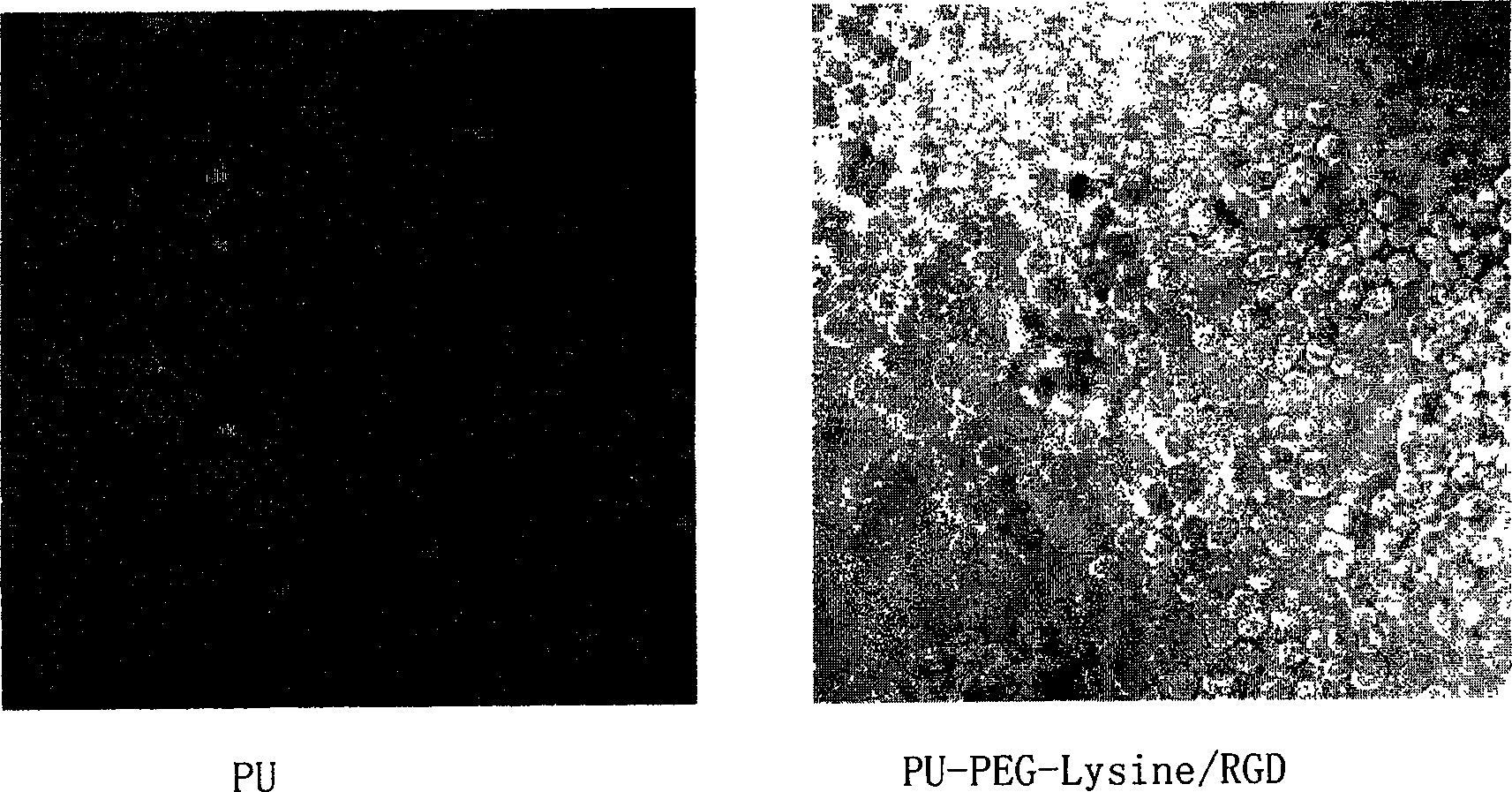 Polyurethane material for improving adhesion growing of cells and rombolytic function