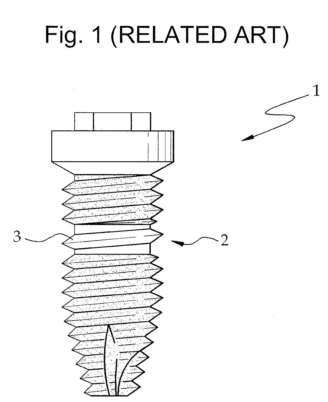 Fixture of dental implant and method of manufacturing the same